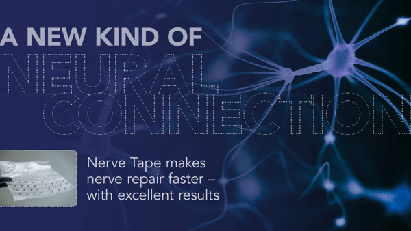 On your nerves, literally
