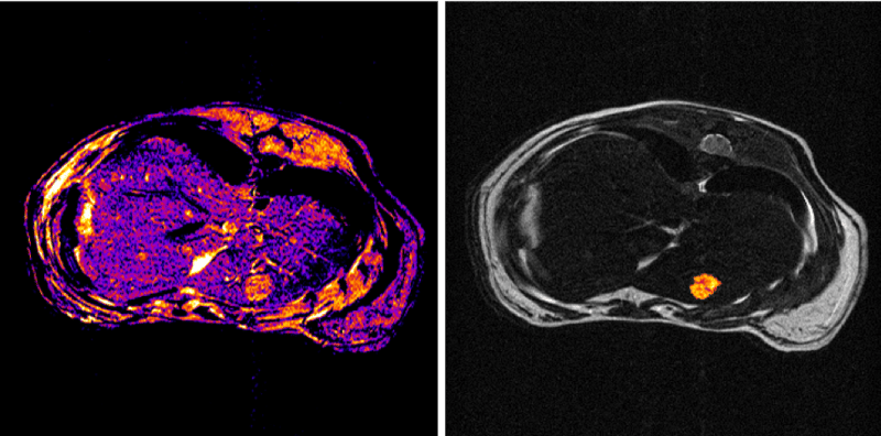 The facility conducts state-of-the-art neuroimaging studies …